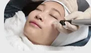 MTS 피부 시술 모습
